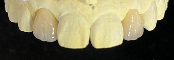 e.max CAD